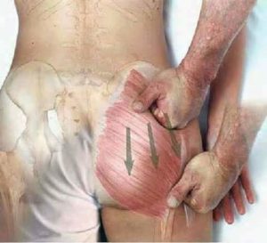 Treament for "Sciatica pain" & "Muscular pain"